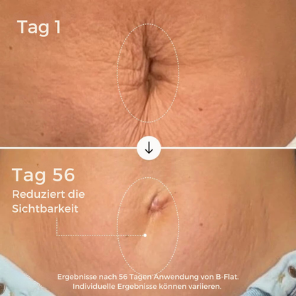 B-Flat | Anti Stretchmarks Creme